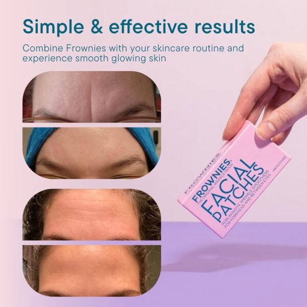 Forehead and Between the Eyes Facial Patches - 144 count - Image 4