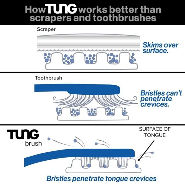 Tung Tongue Brush & Gel Kit | Tongue Cleaner for Adults - Image 2