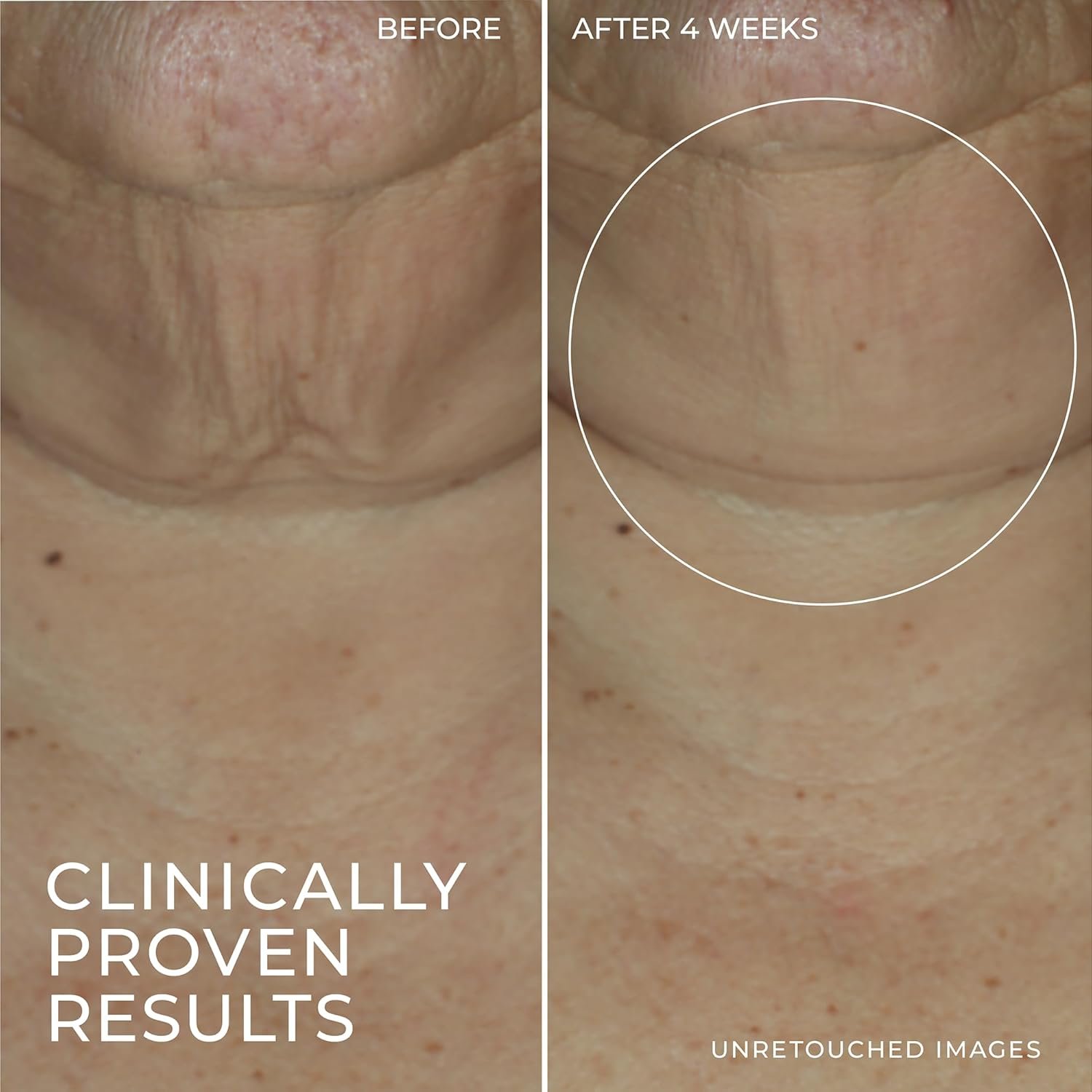 RoC Derm Correxion Retinol Firming Serum Stick